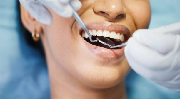 Best Emergency Dentist for Lost Fillings or Crowns in Vandercook Lake, MI