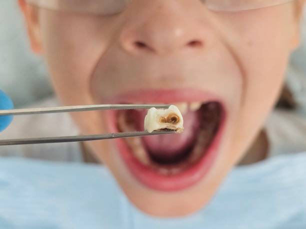 Best 24-Hour Emergency Dentist in Vandercook Lake, MI