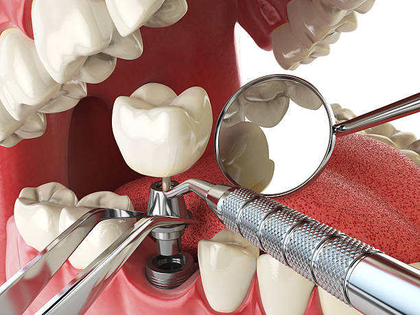 Best Weekend Emergency Dentist in Vandercook Lake, MI