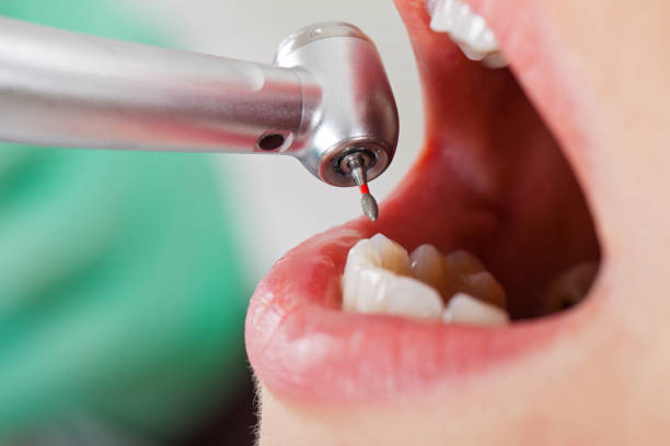 Best Urgent Dental Care for Toothache in Vandercook Lake, MI